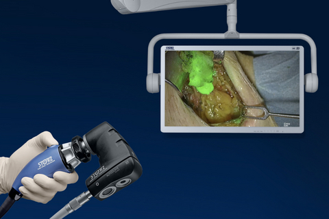KARL STORZ Announces FDA Clearance for Rubina Lens for Open Surgery